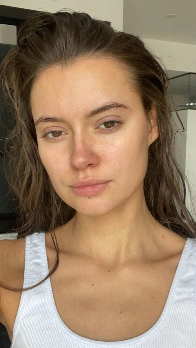 Fresh natural skin after skincare